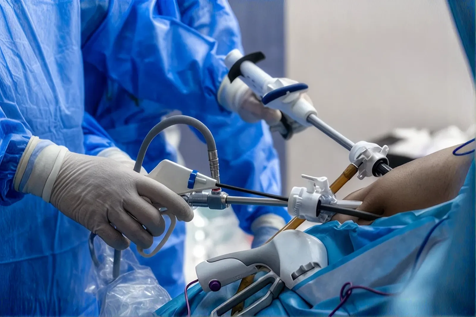Bariatric surgical team at work in a modern operating theatre
